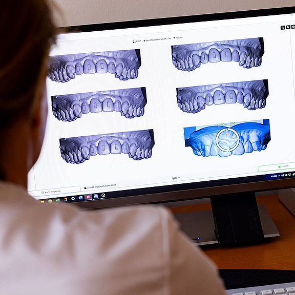 Vorbereitung der durchsichtigen Schienen per digitalem Modell der Zähne