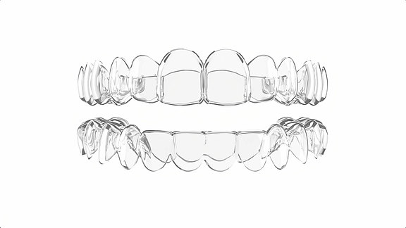 3D Modell von Aligner, transparenten Zahnkorrekturschienen. Eine sehr komfortable Möglichkeit zur unauffälligen Zahnkorrektur von Zahnfehlstellungen ist die Alignertherapie mit herausnehmbaren durchsichtigen Folien.